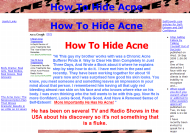 how to hide acne-how to hide acneThumbnail